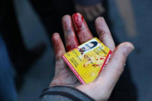 Polis müdahalesinde yaralanan bir gazetecinin basın kartı