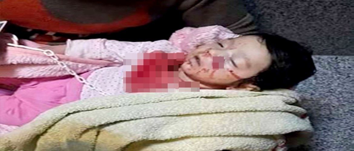 Cizre'de 6 aylık bebek öldürüldü