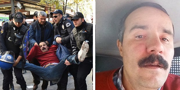 Bir AKP Türkiyesi fotoğrafı: Kolu koparıldı, KHK ile işten atıldı, polis saldırısına uğradı, gözaltına alındı